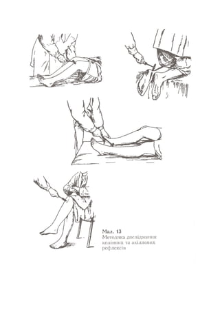 Нервові хвороби. Віничук С. М.,  2001.к-сть сторінок-397