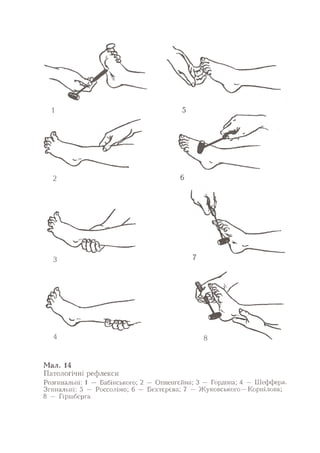 Нервові хвороби. Віничук С. М.,  2001.к-сть сторінок-397