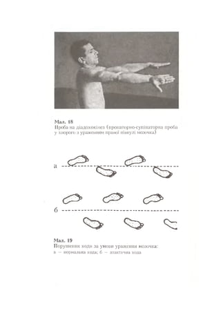 Нервові хвороби. Віничук С. М.,  2001.к-сть сторінок-397