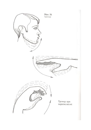 Нервові хвороби. Віничук С. М.,  2001.к-сть сторінок-397