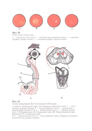 Нервові хвороби. Віничук С. М.,  2001.к-сть сторінок-397