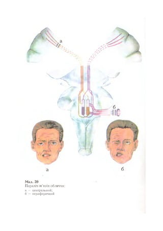 Нервові хвороби. Віничук С. М.,  2001.к-сть сторінок-397