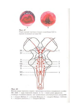 Нервові хвороби. Віничук С. М.,  2001.к-сть сторінок-397