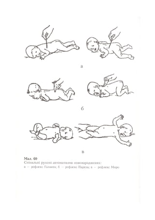 Нервові хвороби. Віничук С. М.,  2001.к-сть сторінок-397