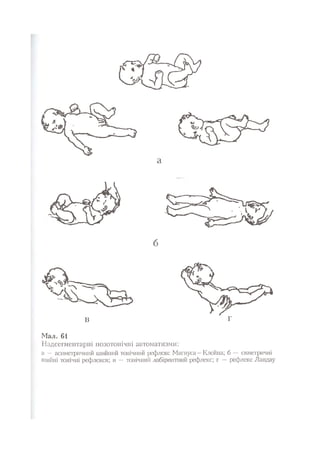 Нервові хвороби. Віничук С. М.,  2001.к-сть сторінок-397