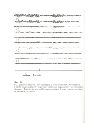 Нервові хвороби. Віничук С. М.,  2001.к-сть сторінок-397