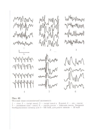 Нервові хвороби. Віничук С. М.,  2001.к-сть сторінок-397