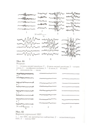 Нервові хвороби. Віничук С. М.,  2001.к-сть сторінок-397