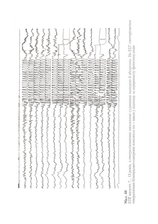 Нервові хвороби. Віничук С. М.,  2001.к-сть сторінок-397