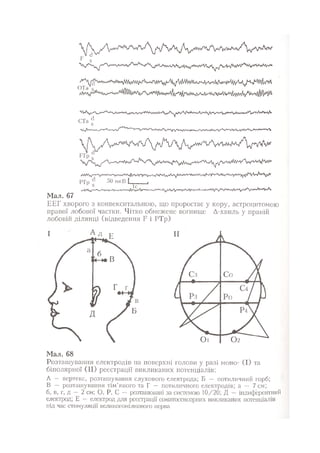 Нервові хвороби. Віничук С. М.,  2001.к-сть сторінок-397