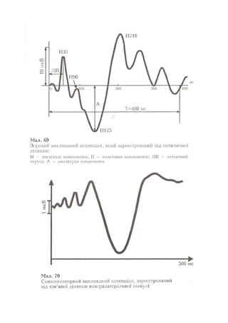 Нервові хвороби. Віничук С. М.,  2001.к-сть сторінок-397