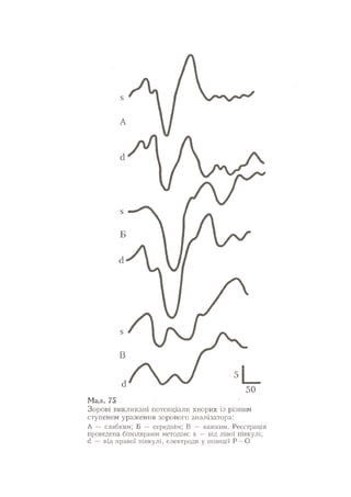 Нервові хвороби. Віничук С. М.,  2001.к-сть сторінок-397