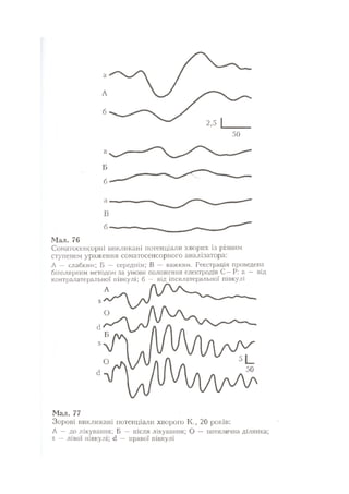 Нервові хвороби. Віничук С. М.,  2001.к-сть сторінок-397