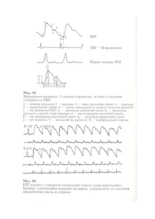 Нервові хвороби. Віничук С. М.,  2001.к-сть сторінок-397