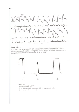 Нервові хвороби. Віничук С. М.,  2001.к-сть сторінок-397