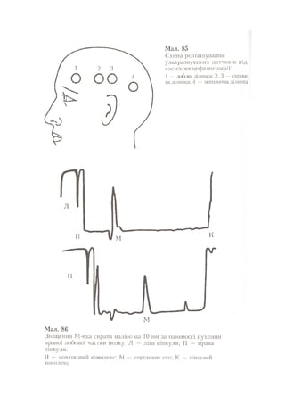 Нервові хвороби. Віничук С. М.,  2001.к-сть сторінок-397