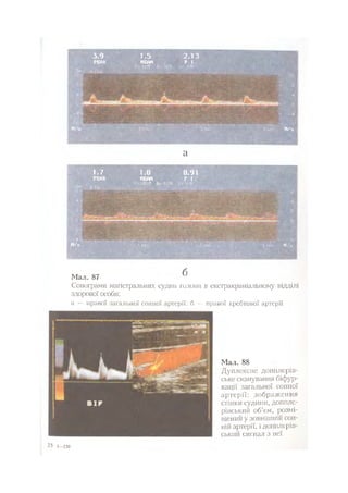 Нервові хвороби. Віничук С. М.,  2001.к-сть сторінок-397