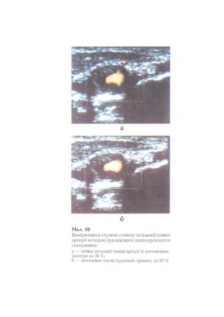 Нервові хвороби. Віничук С. М.,  2001.к-сть сторінок-397