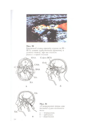 Нервові хвороби. Віничук С. М.,  2001.к-сть сторінок-397