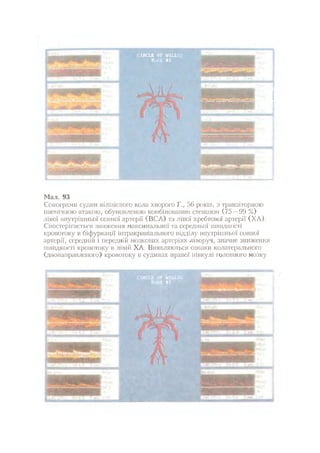 Нервові хвороби. Віничук С. М.,  2001.к-сть сторінок-397