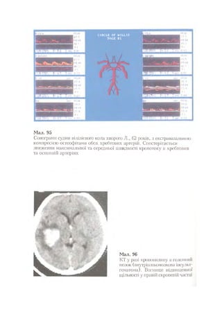 Нервові хвороби. Віничук С. М.,  2001.к-сть сторінок-397