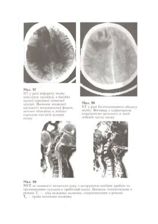 Нервові хвороби. Віничук С. М.,  2001.к-сть сторінок-397
