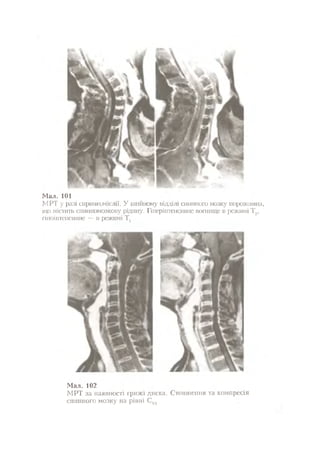Нервові хвороби. Віничук С. М.,  2001.к-сть сторінок-397