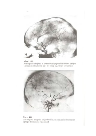 Нервові хвороби. Віничук С. М.,  2001.к-сть сторінок-397