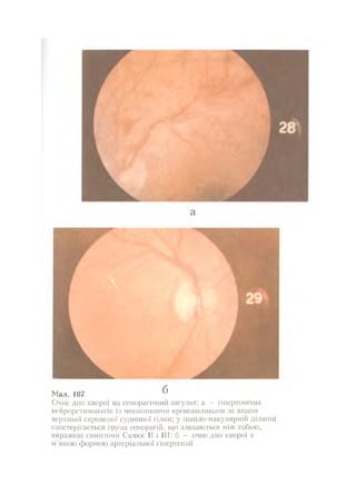 Нервові хвороби. Віничук С. М.,  2001.к-сть сторінок-397
