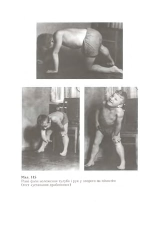 Нервові хвороби. Віничук С. М.,  2001.к-сть сторінок-397