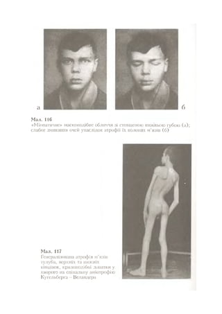 Нервові хвороби. Віничук С. М.,  2001.к-сть сторінок-397