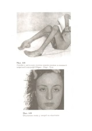 Нервові хвороби. Віничук С. М.,  2001.к-сть сторінок-397