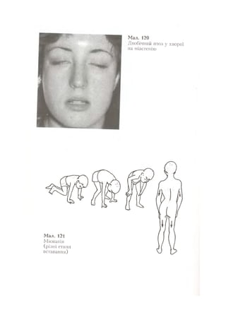 Нервові хвороби. Віничук С. М.,  2001.к-сть сторінок-397