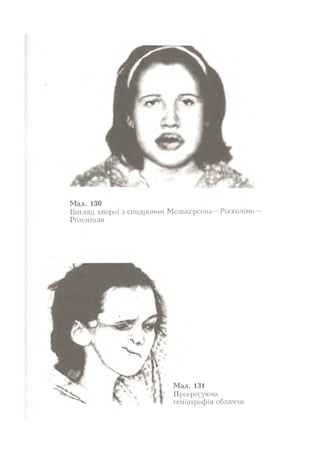 Нервові хвороби. Віничук С. М.,  2001.к-сть сторінок-397