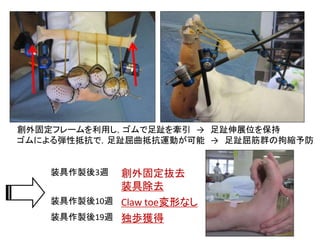 下肢創外固定術後装具療法の試み | PPT