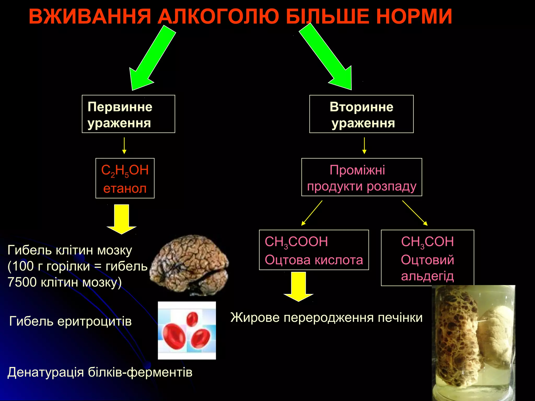 ВЖИВАННЯ АЛКОГОЛЮ БІЛЬШЕ НОРМИ 
Первинне 
ураження 
Вторинне 
ураження 
С2Н5ОН 
етанол 
Проміжні 
продукти розпаду 
Гибель клітин мозку 
(100 г горілки = гибель 
7500 клітин мозку) 
СН3СООН 
Оцтова кислота 
СН3СОН 
Оцтовий 
альдегід 
Гибель еритроцитів Жирове переродження печінки 
Денатурація білків-ферментів 
 