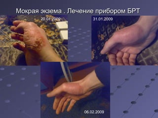 ММооккррааяя ээккззееммаа .. ЛЛееччееннииее ппррииббоорроомм ББРРТТ 
20.01.2009 31.01.2009 
06.02.2009 
 