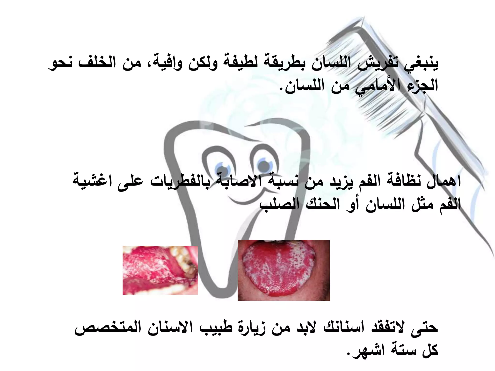 ‫ا‬ ‫من‬ ،‫افية‬‫و‬ ‫ولكن‬ ‫لطيفة‬ ‫بطريقة‬ ‫اللسان‬ ‫تفريش‬ ‫ينبغي‬‫نحو‬ ‫لخلف‬
‫اللسان‬ ‫من‬ ‫األمامي‬ ‫ء‬‫الجز‬.
‫اغ‬ ‫على‬ ‫بالفطريات‬ ‫االصابة‬ ‫نسبة‬ ‫من‬ ‫يزيد‬ ‫الفم‬ ‫نظافة‬ ‫اهمال‬‫شية‬
‫الصلب‬ ‫الحنك‬ ‫أو‬ ‫اللسان‬ ‫مثل‬ ‫الفم‬
‫الم‬ ‫االسنان‬ ‫طبيب‬ ‫ة‬‫زيار‬ ‫من‬ ‫البد‬ ‫اسنانك‬ ‫التفقد‬ ‫حتى‬‫تخصص‬
‫اشهر‬ ‫ستة‬ ‫كل‬.
 