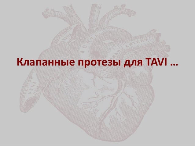 Имплантация аортального клапана