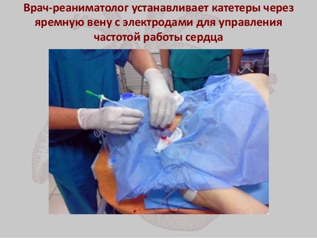 Трансапикальная имплантация аортального клапана Трансапикальная имплантация аортального клапана