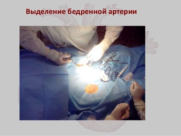 Имплантация аортального клапана