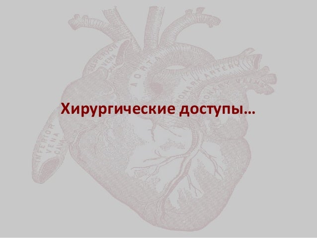 Имплантация аортального клапана