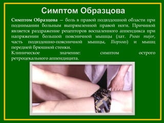 Симптом Образцова — боль в правой подвздошной области при
поднимании больным выпрямленной правой ноги. Причиной
является раздражение рецепторов воспаленного аппендикса при
напряжении большой поясничной мышцы (лат. Psoas major,
часть подвздошно-поясничной мышцы, Iliopsoas) и мышц
передней брюшной стенки.
Клиническое значение: симптом острого
ретроцекального аппендицита.
 