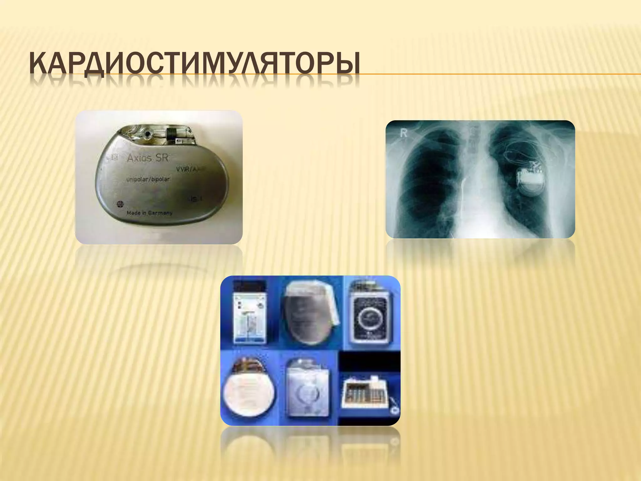 КАРДИОСТИМУЛЯТОРЫ
 