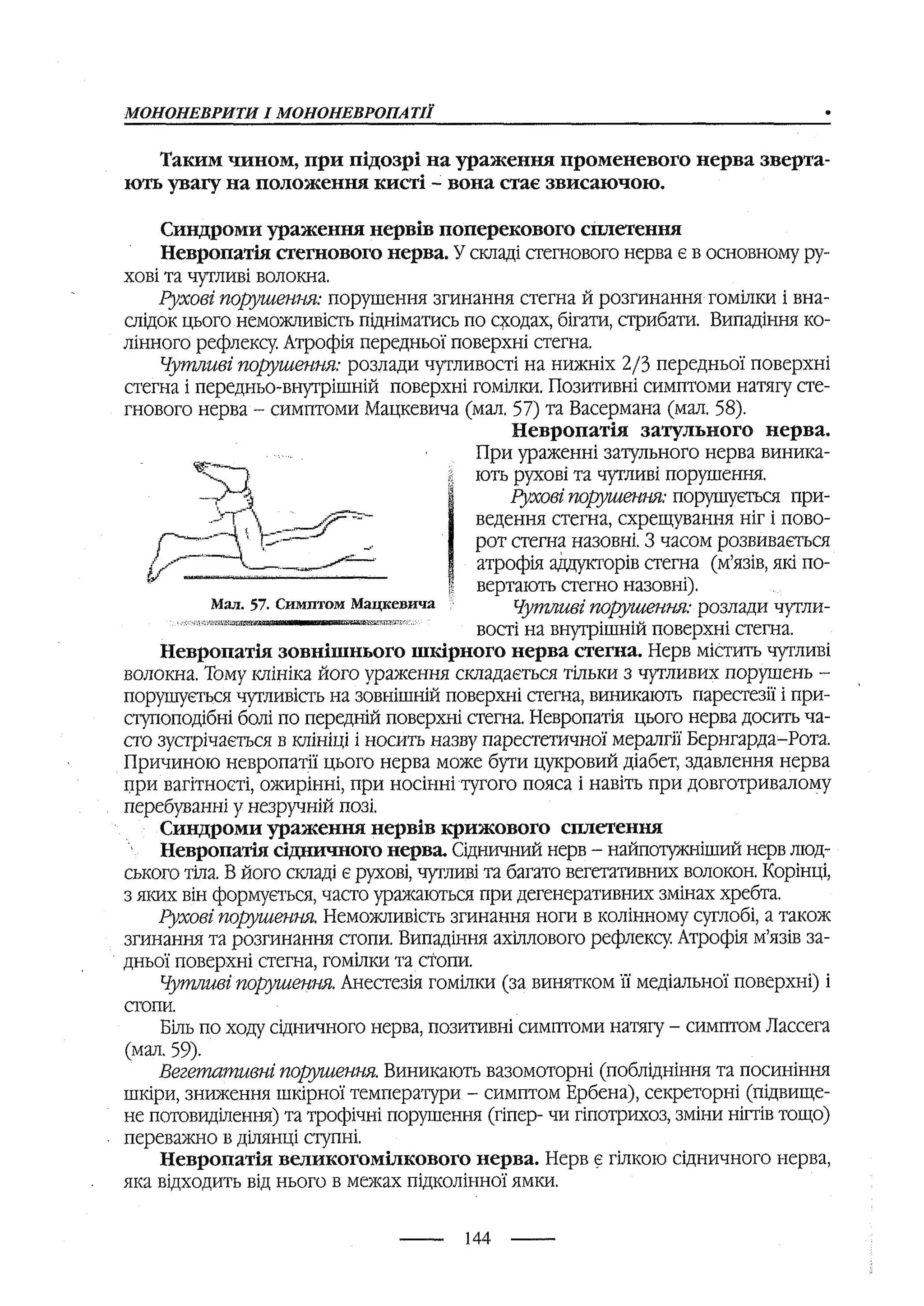 медсестринство в неврології за ред. В.М. Пашковський, І.І. Кричун, І.І. Кривецька, І.Я. ст.254 , 2003р