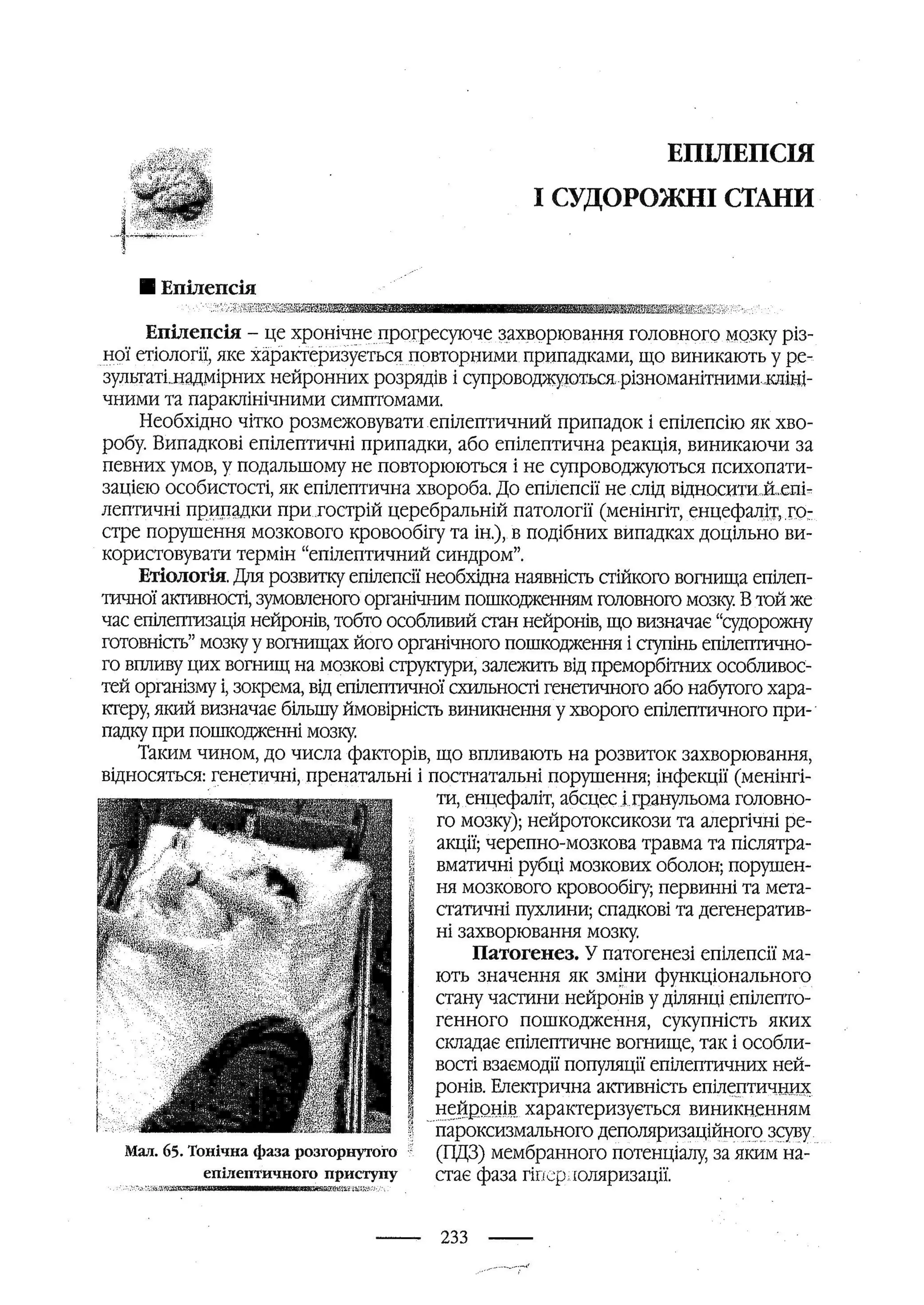 медсестринство в неврології за ред. В.М. Пашковський, І.І. Кричун, І.І. Кривецька, І.Я. ст.254 , 2003р