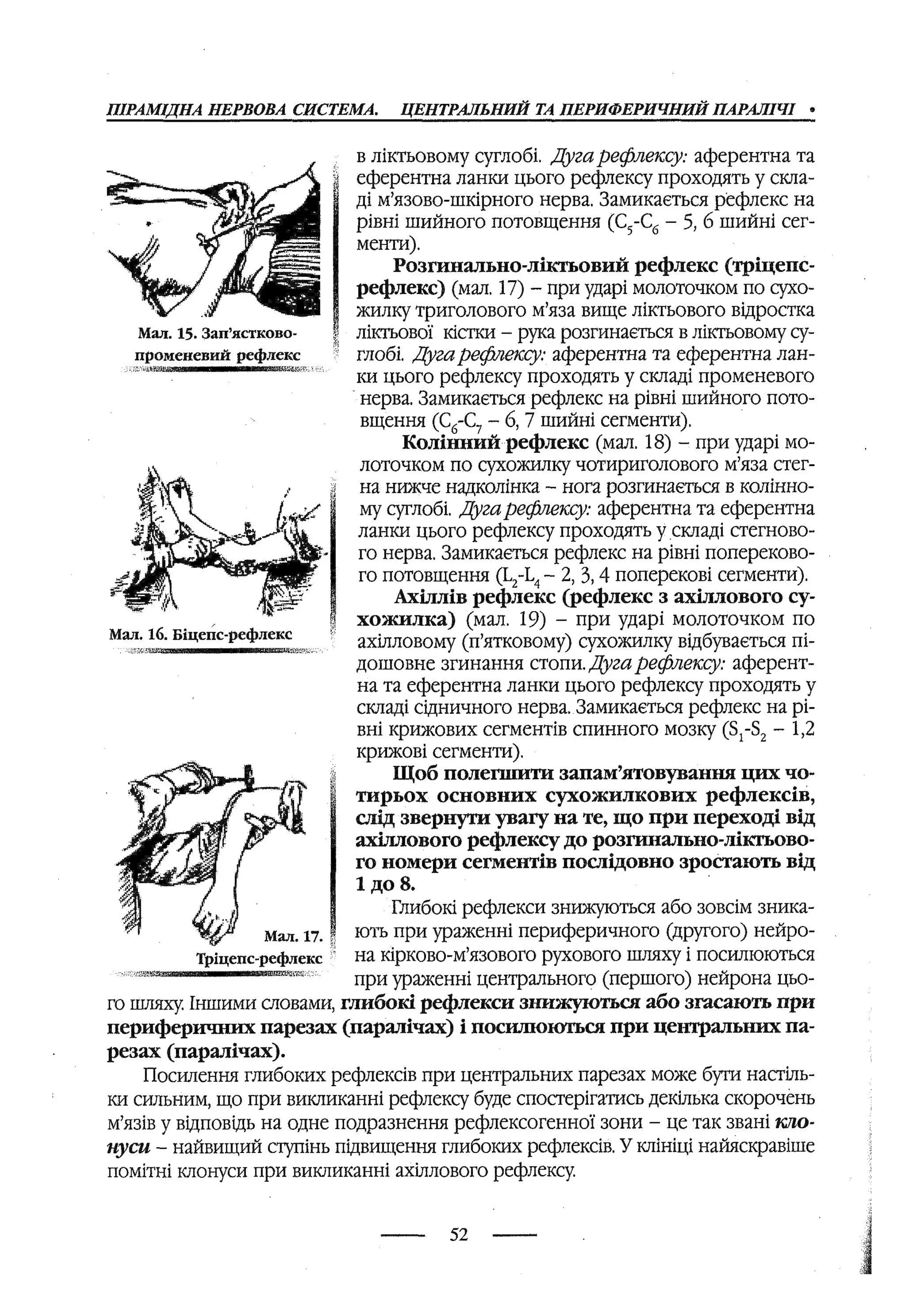 медсестринство в неврології за ред. В.М. Пашковський, І.І. Кричун, І.І. Кривецька, І.Я. ст.254 , 2003р