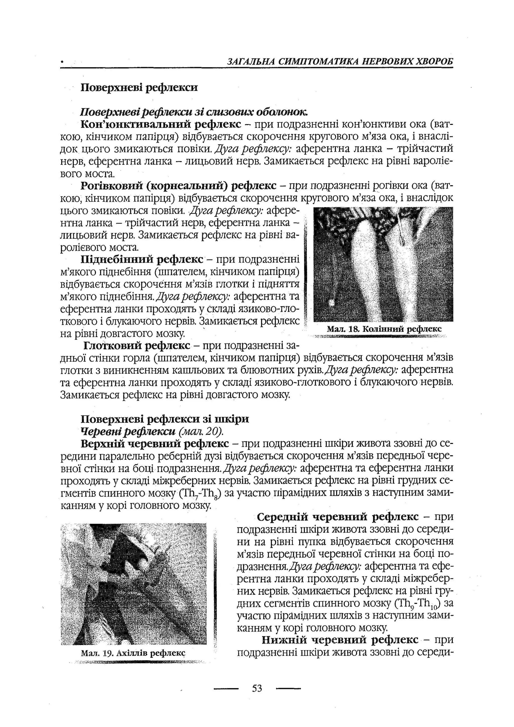 медсестринство в неврології за ред. В.М. Пашковський, І.І. Кричун, І.І. Кривецька, І.Я. ст.254 , 2003р