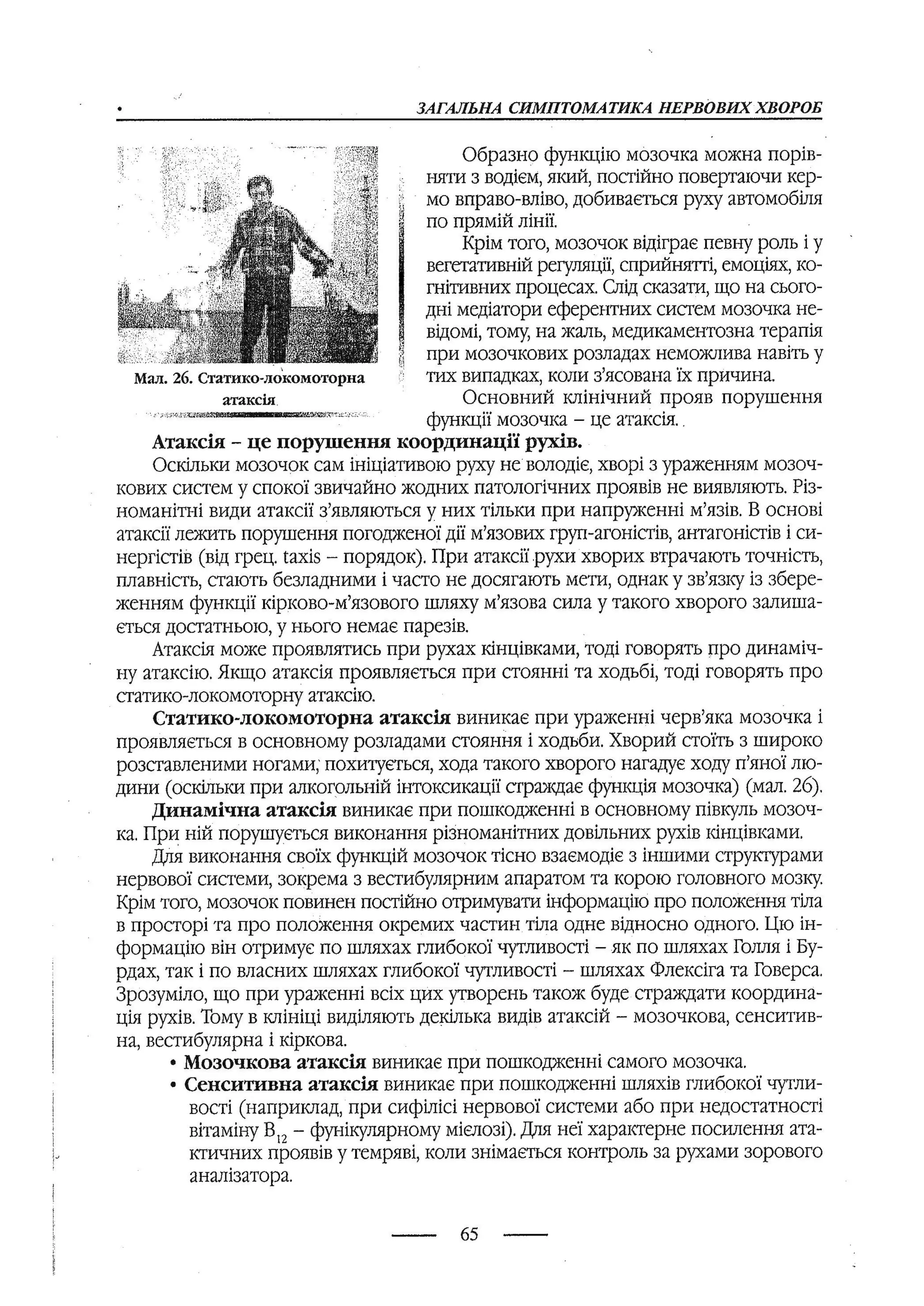 медсестринство в неврології за ред. В.М. Пашковський, І.І. Кричун, І.І. Кривецька, І.Я. ст.254 , 2003р