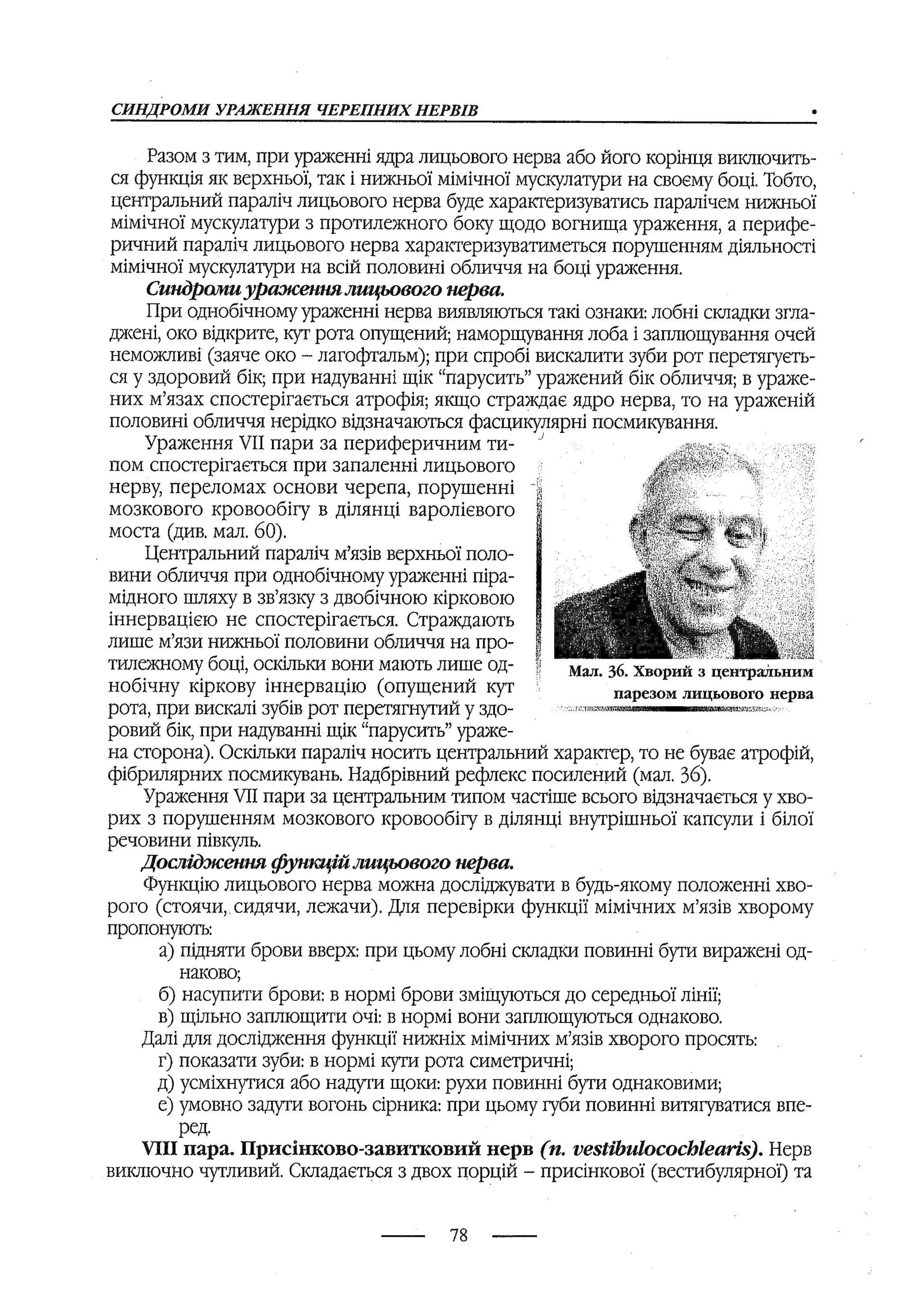 медсестринство в неврології за ред. В.М. Пашковський, І.І. Кричун, І.І. Кривецька, І.Я. ст.254 , 2003р